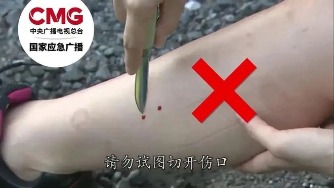 亡当地曾公布3家医院有抗蛇毒血清尊龙凯时APP游客三亚疑被蛇咬身